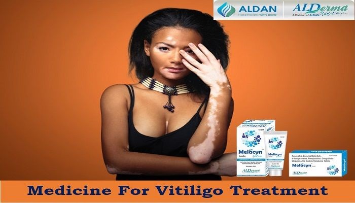 Melacyn: The Best Medicine For Vitiligo Treatment In The World