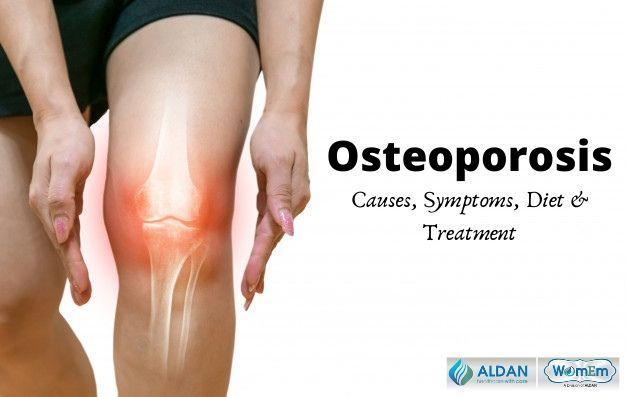 Osteoporosis Treatment, Causes, Symptoms, Diet & Prevention