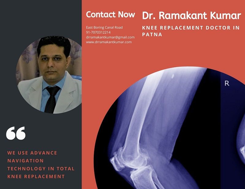 Dr. Ramakant Kumar – Best Doctor for Total Knee Replacement in Patna