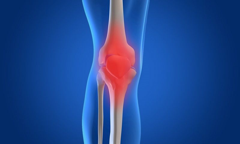How to Manage Pain, Swelling, and Bruising After a Total Knee Replacement