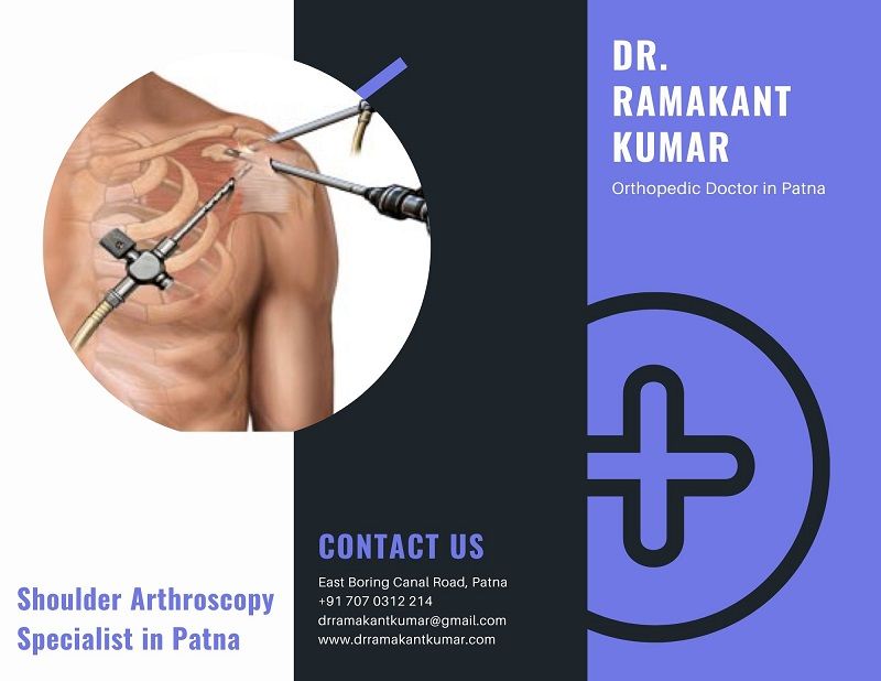 Shoulder Arthroscopy Specialist in Patna