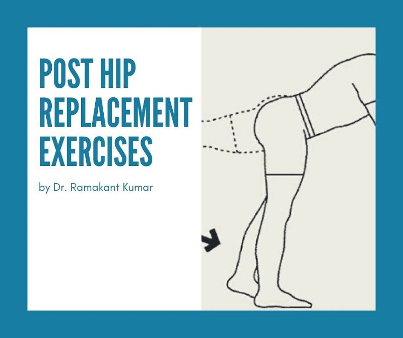 6 Best Post Hip Replacement Exercises | Dr. Ramakant Kumar