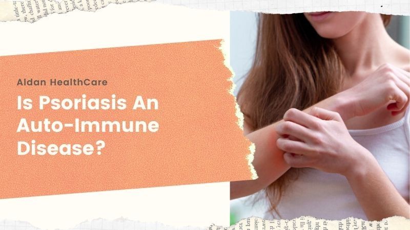 Is Psoriasis an Autoimmune Disease? – Know Here