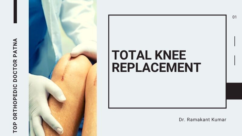 Total Knee Replacement – Procedure, Complications & Exercises