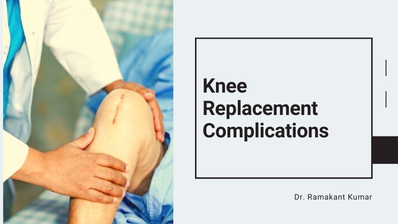Possible Post-Knee Replacement Complications and Risks