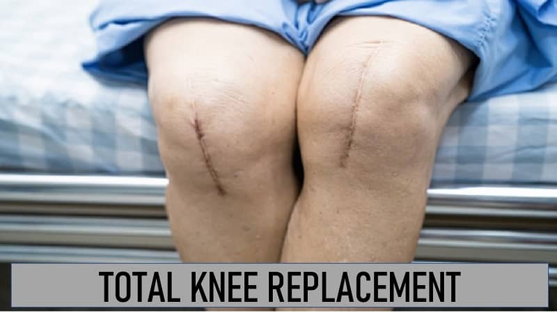 Total Knee Replacement Exercises | Total Knee Replacement Recovery