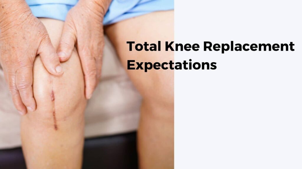Total Knee Replacement Expectations Knee Replacement Recovery Tips 8294