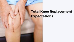 Total Knee Replacement Expectations | Knee Replacement Recovery Tips