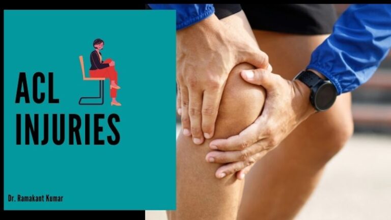 ACL Injuries {Sprained ACL Injury Recovery Time & Symptoms}