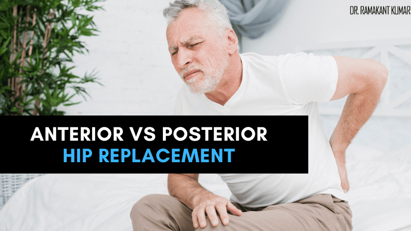Anterior vs Posterior Hip Replacement Surgery