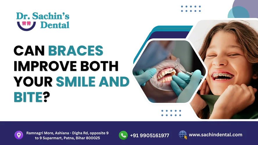 How Can Braces Improve Your Smile and Bite in Patna?