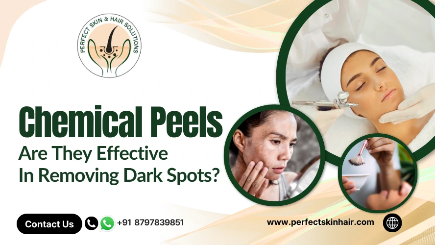 Can Chemical Peels Remove Dark Spots