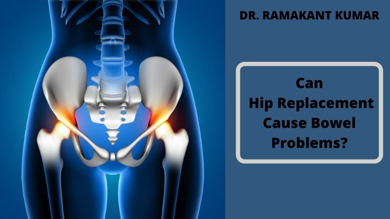 Is it Possible for Hip Replacement to Cause Bowel Issues?