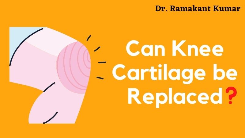 Can Knee Cartilage be Replaced [Knee Cartilage Surgery Cost]