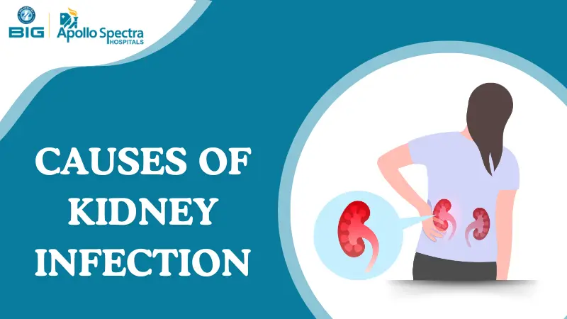 What is the Most Common Cause of a Kidney Infection?