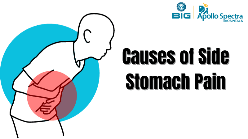 Causes of Side Stomach Pain