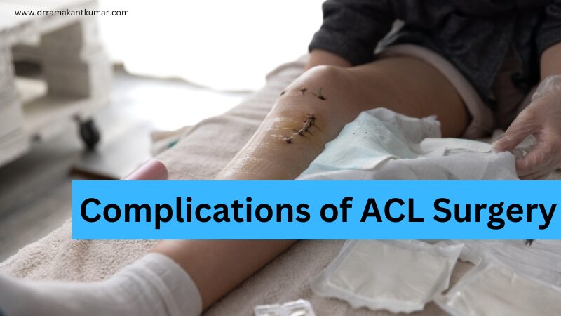 common Complications of ACL Surgery