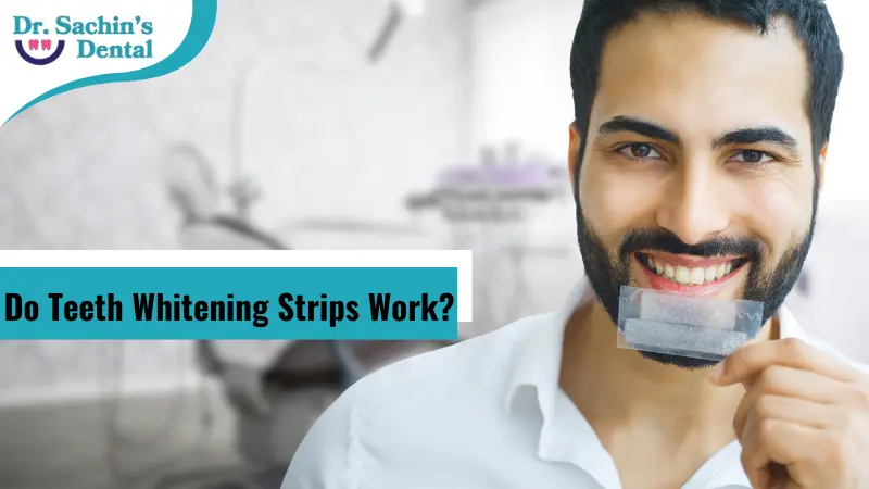 How to Use Teeth Whitening Strips – Do They Really Work?