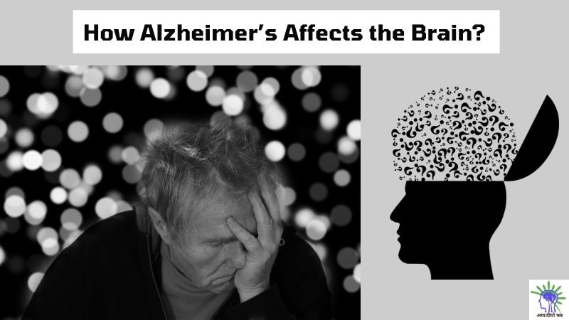 How Alzheimer’s Affects the Brain