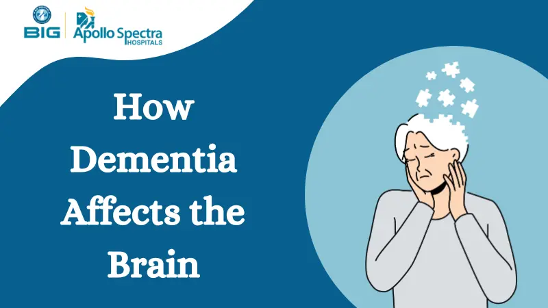 What Does Dementia Do to the Brain? 7 Neurological Effects