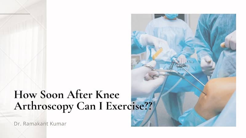 How Soon After Knee Arthroscopy Can I Exercise?