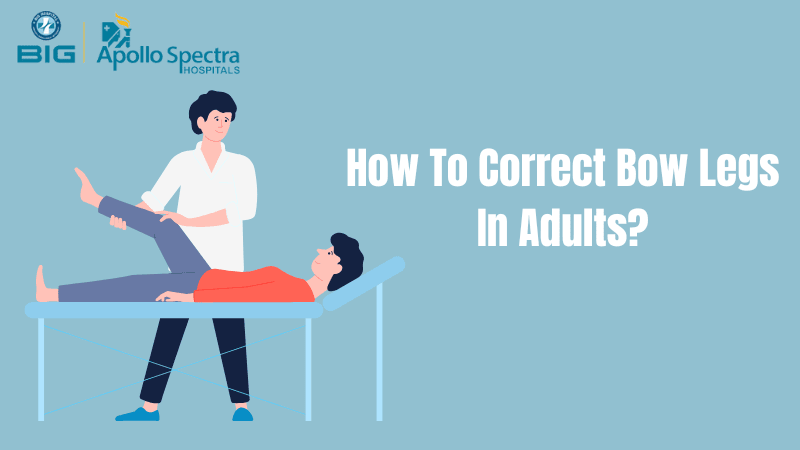 How To Correct Bow Legs In Adults |Is There Any Bone Specialist in Patna?