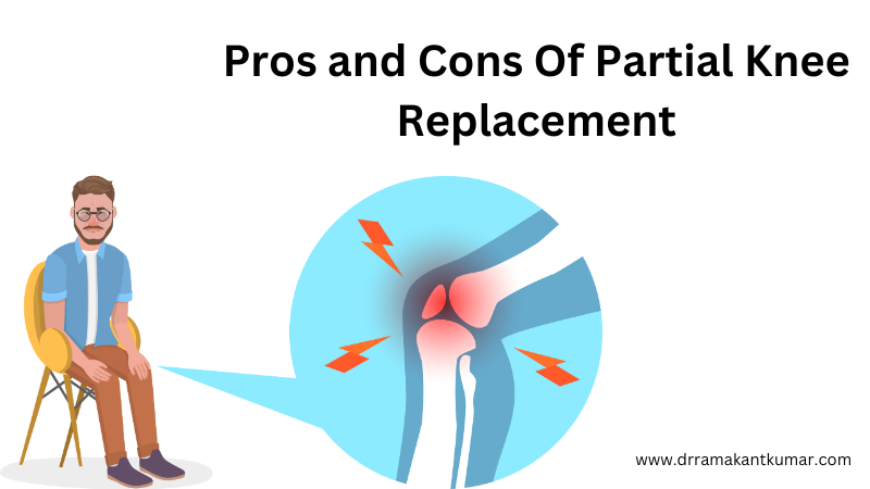 Partial Knee Replacement Success Rate – Pros and Cons