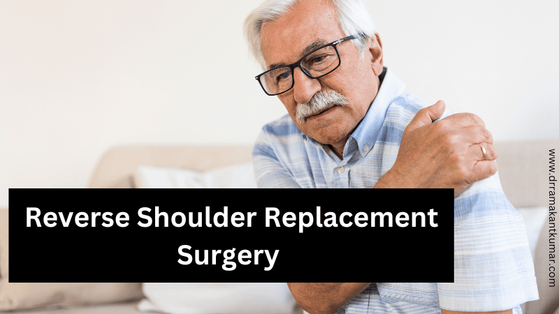 Reverse Shoulder Replacement Surgery