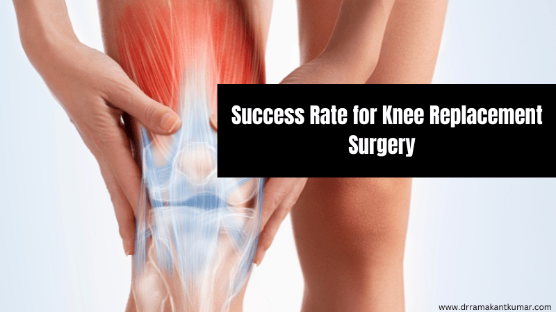 Success Rate for Knee Replacement Surgery and Long-Term Benefits