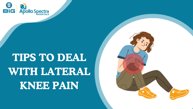 Tips to deal with lateral knee pain