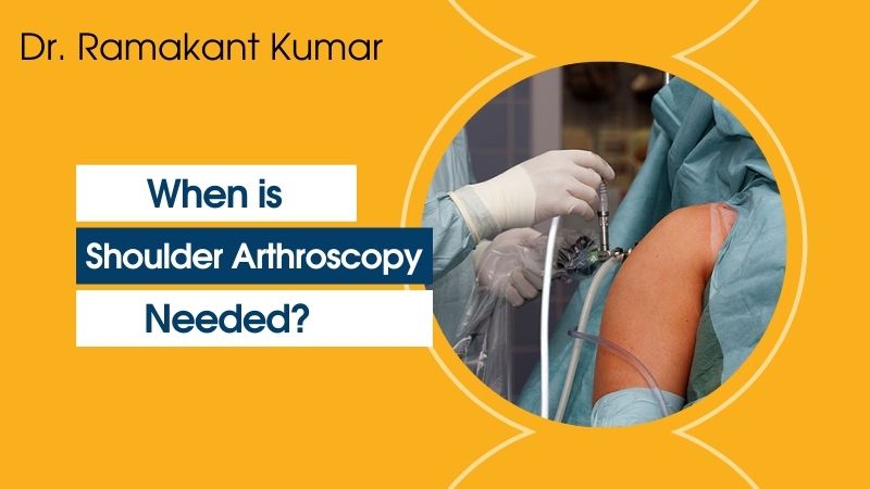 When is Shoulder Arthroscopy Needed? Ask Dr. Ramakant Kumar