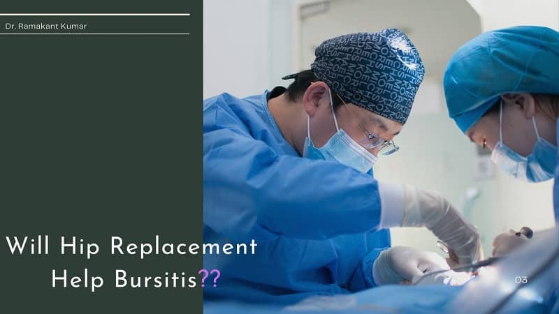 Will Hip Replacement Help Bursitis? {What Aggravates Hip Bursitis}