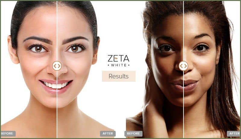 Zeta White Skin Care