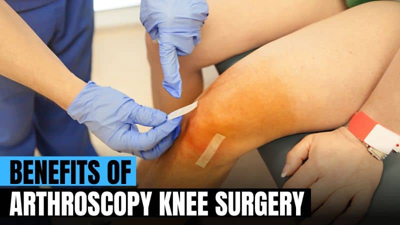 4 Top Benefits of Arthroscopy Knee Surgery