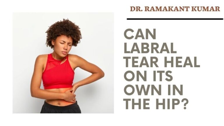 can-labral-tear-heal-on-its-own-in-the-hip-torn-hip-labrum-symptoms