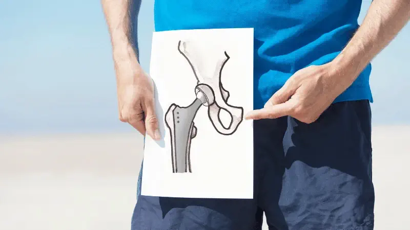 hip replacement cost in Patna