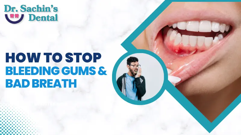 how to stop bleeding gums and bad breath