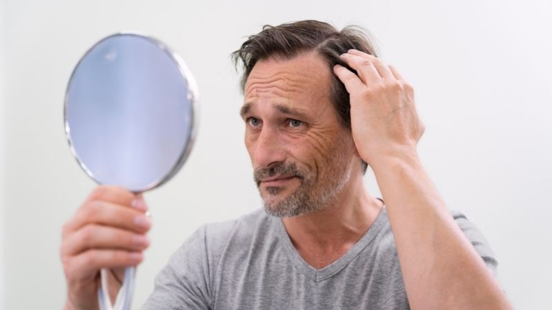 Will Profollica Hair Loss Treatment for Men Work? Know Here