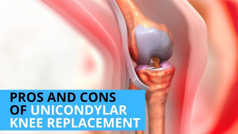 What are the Pros and Cons of Unicondylar Knee Replacement?